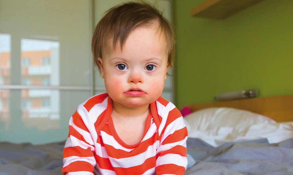Porträt eines Kleinkindes mit Down-Syndrom, das auf einem Bett sitzt