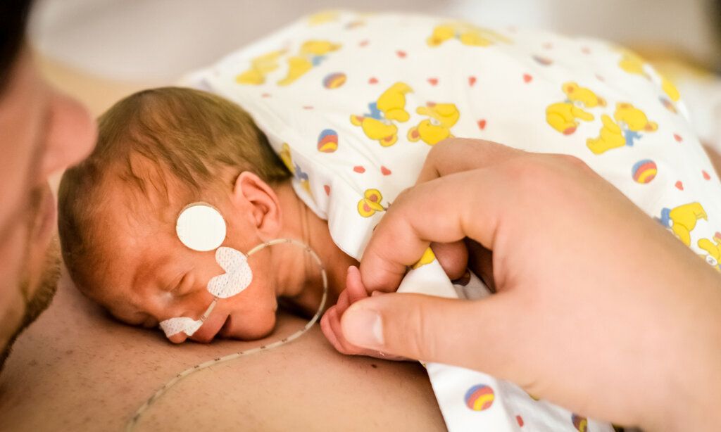 ein Frühchen mit einem Schlauchen in der Nase liegt auf der Brust des Vaters, er hält die kleine Hand fest