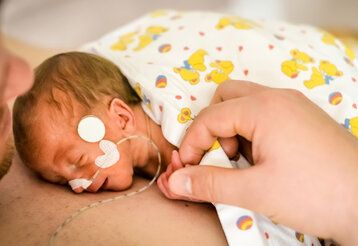 ein Frühchen mit einem Schlauchen in der Nase liegt auf der Brust des Vaters, er hält die kleine Hand fest