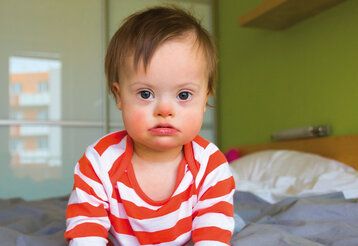 Porträt eines Kleinkindes mit Down-Syndrom, das auf einem Bett sitzt